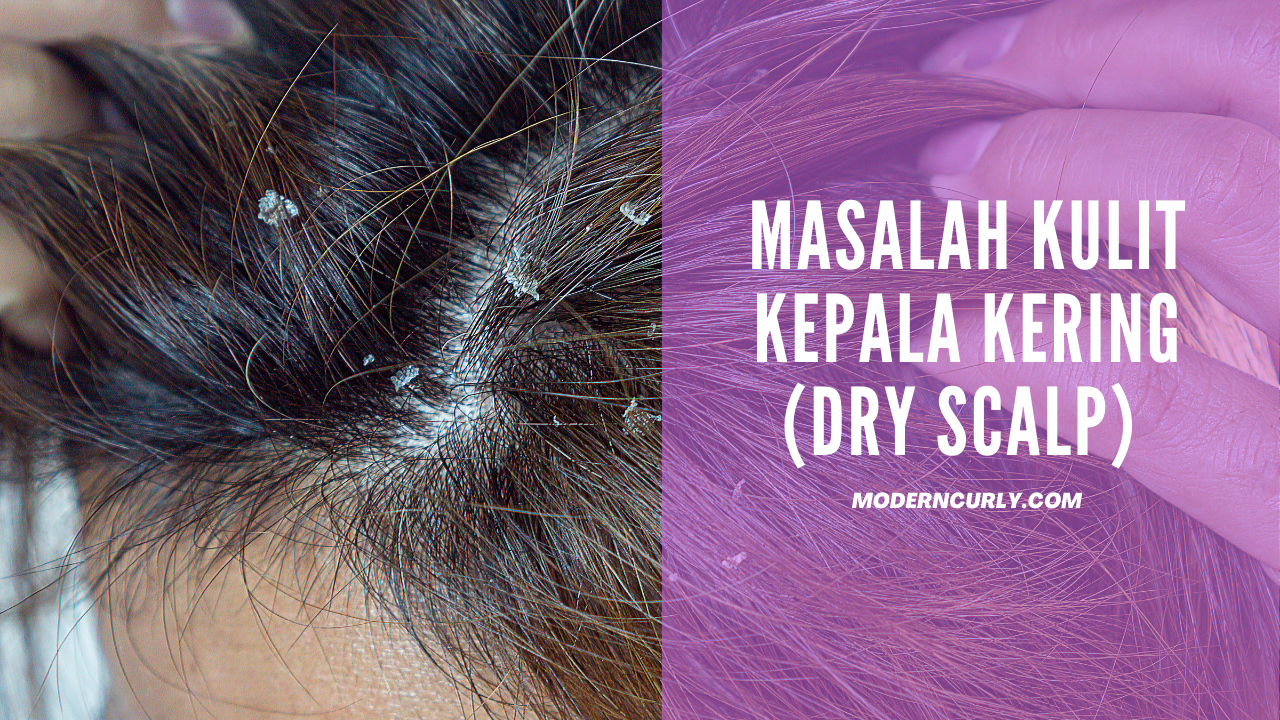 Masalah Kulit Kepala Kering Ciri Ciri Penyebab Dan Cara Merawatnya