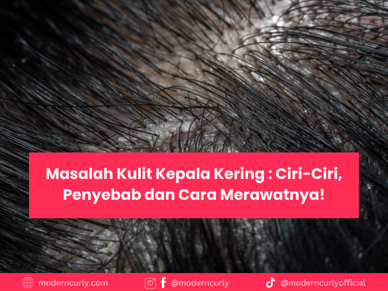 Masalah Kulit Kepala Kering (Dry Scalp) : Ciri-Ciri, Penyebab dan Cara Merawatnya!